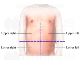 The Abdominal Quadrants of a Child