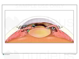 Eye Anatomy - Angle Closure within the Eye