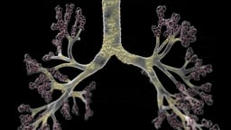Mucus Buildup in Chronic Bronchitis