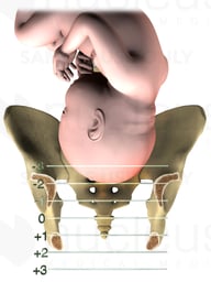 Anterior Birth Stations