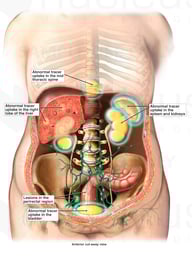 Subsequent Condition