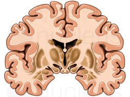 Brain, Anterior Cut-away View