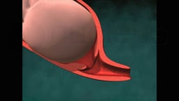 Cervix Dilatation (Dilation) and Effacement During Labor