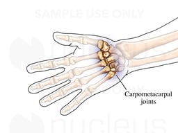 The Carpometacarpal Joints