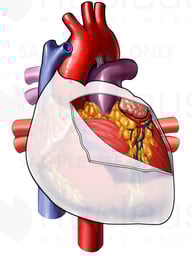 Pericardium