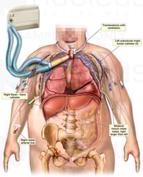 Extensive Medical Treatments