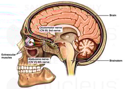 Cranial Nerves: Oculomotor (III) and Abducens (VI)