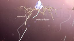 Neuron with Damaged Axon Labeled