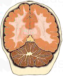 Brain, Oblique Cut-away View