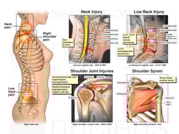 Multiple Injuries Following Motor Vehicle Accident