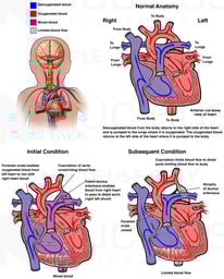 Fetal Circulation