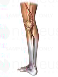 Posteromedial View of Right Leg Artery Anatomy with Popliteal Blood Clot
