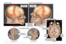 Traumatic Head and Neck Injuries