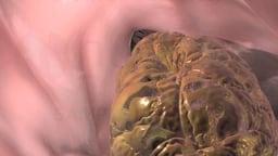 Digestion: Chewing, Swallowing, Stomach Acid