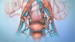 Treatment Options for Ovarian Cancer