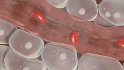 Understanding CKD Anemia