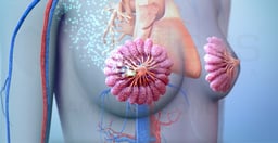 What is Chemotherapy for Breast Cancer? 