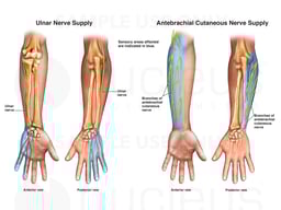 Cutaneous Nerve Supply to the Left Arm, Wrist and Hand