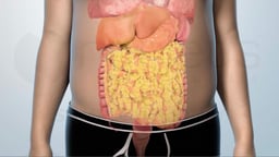 Opciones de tratamiento para la diabetes de tipo 2