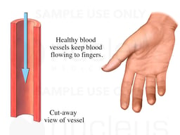Normal Vessel Lumen