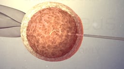 In Vitro Fertilization
