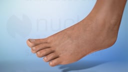 Diabetic Foot Care