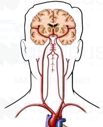 Arteries of the Head, Neck and Brain