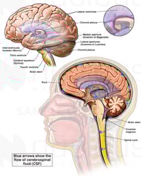 Intracranial Circulation of Cerebrospinal Fluid (CSF)