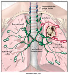 Regional Lymph Nodes of the Thorax