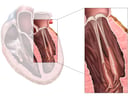 Normal Anatomy of the Mitral (Bicuspid) Valve of the Heart