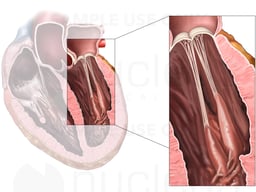 Normal Anatomy of the Mitral (Bicuspid) Valve of the Heart