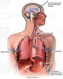 Medical and Surgical Treatments