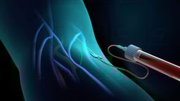 Blood Test for Cholesterol