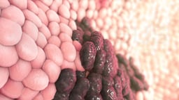 Treatments for Head and Neck Cancer