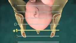 Birth Stations of Presentation: 1/3 System (Anterior View)
