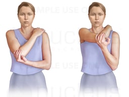 Rotator Cuff Exercise: Posterior Stretches