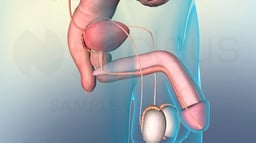 Benign Prostatic Hyperplasia vs. Prostate Cancer