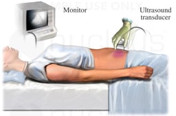 Pelvic Ultrasound