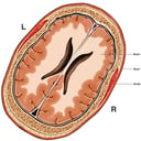 Normal Anatomy of the Brain