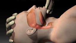 CPR Positions: Head-Tilt/Chin-Lift and Jaw Thrust