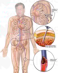 Multiple Medical Treatments