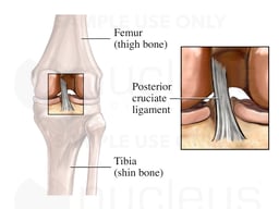 The Posterior Cruciate Ligament