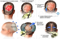 Proposed Future Surgical Repair of Scalp Injury