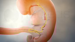 Pull-Through Procedure for Hirschsprung Disease