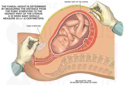 Measurement of Fundal Height