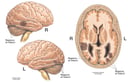 Brain Injury to the Cerebrum and Cerebellum