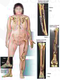 Multiple Surgical Procedures