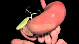 Surgical Treatments for Pancreatic Cancer