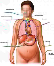 Multiple Medical Treatments