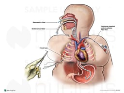 Multiple Medical Treatments